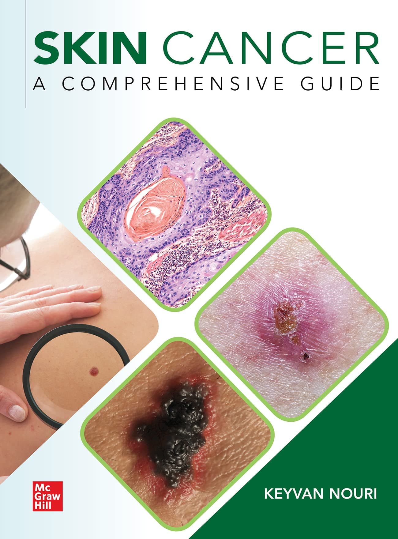 Skin Cancer: A Comprehensive Guide 1 by Nouri, Keyvan textbook cover